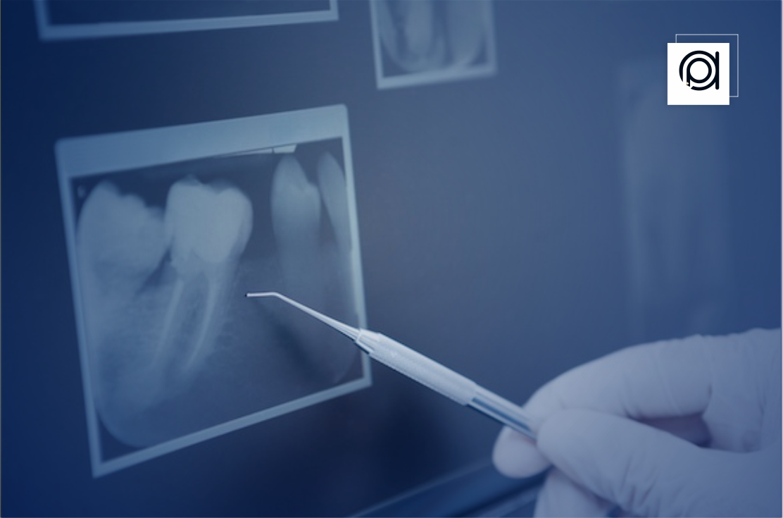 Digital Dental Imaging